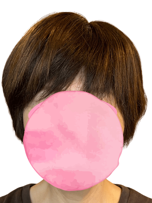 医療美容師のカット後のヘアピース装着・正面