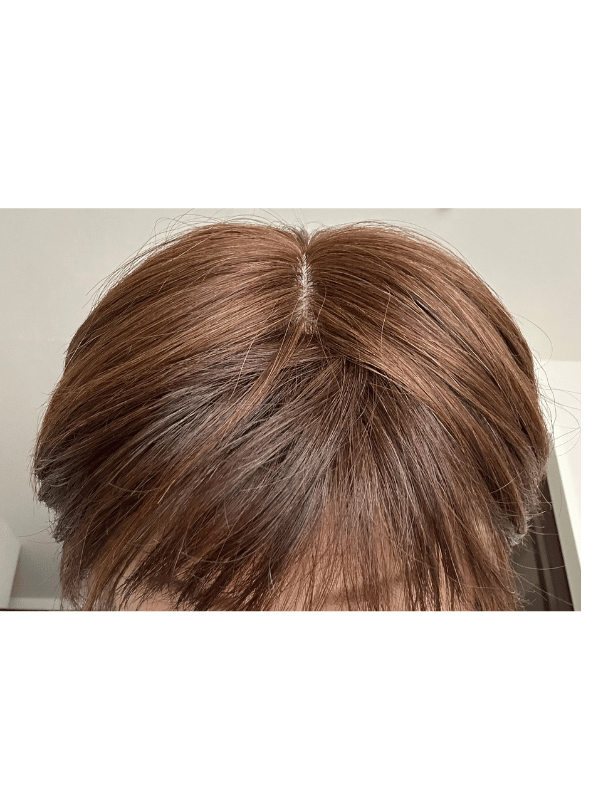 カット前のヘアピースのつむじ部分の接写。人工皮膚の分け目