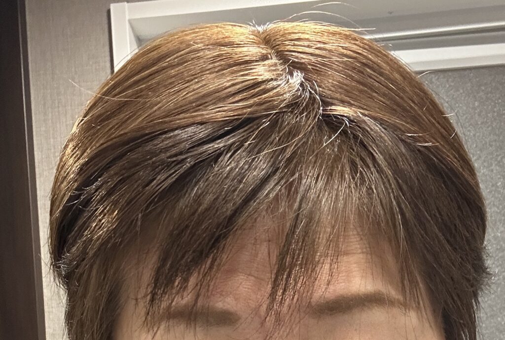 カット前のヘアピースの境目の接写。地毛が下から覗いて二層になっている